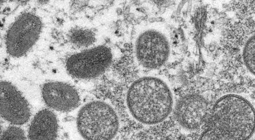 韩国首次报告疑似感染猴痘病例 正在接受病毒检测