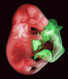 2007年最佳显微照片 转基因老鼠胚胎居首(图)