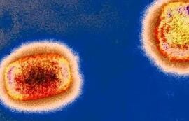 世卫组织说多国发现猴痘病例属“非典型”