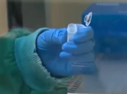 尼日利亚、荷兰和马耳他分别报告猴痘确诊病例