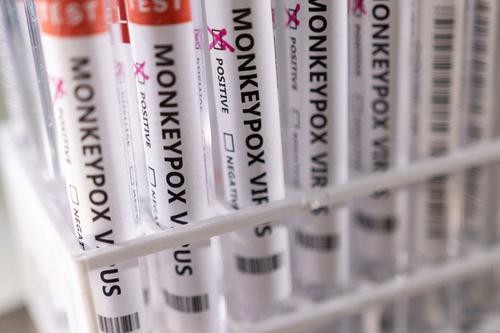 英国已有超1700例猴痘病例 多组织批疫苗接种缓慢