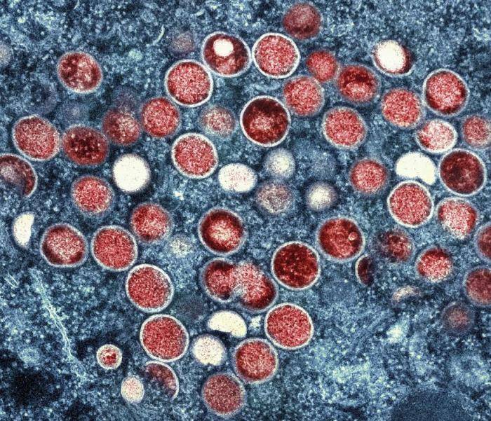 美国伊利诺伊州宣布因猴痘疫情进入公共卫生紧急状态