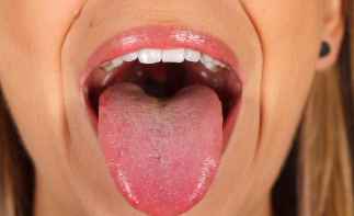 舌头上出现齿痕？是因为什么原因而引起的