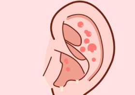 导致儿童患中耳炎的原因主要有这七大诱因