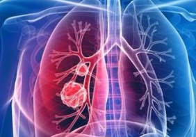 肺不好的表现有哪些？4大迹象早发现早控制