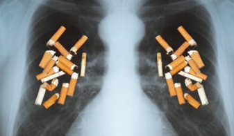 吸二手烟有6大危害 吸烟的人该如何预防肺癌