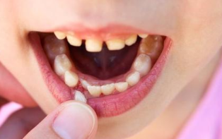 宝宝什么时候长牙？长牙期这4点可缓解不适