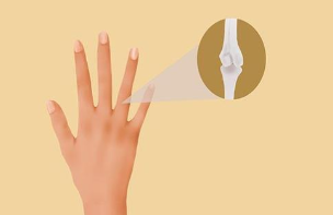 手指关节疼痛是什么病？帮你分析了这6种原因