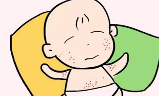 湿疹为什么会反复发作？有湿疹能打疫苗吗