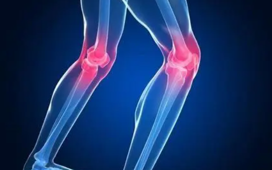 “跑步膝”这样来预防 为何年轻人膝骨关节炎增多