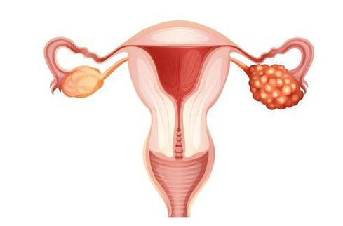 是什么引起的卵巢早衰？无外乎这几个原因