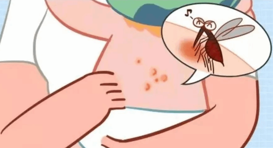 虫咬皮炎都有哪些表现呢？被咬之后如何处理