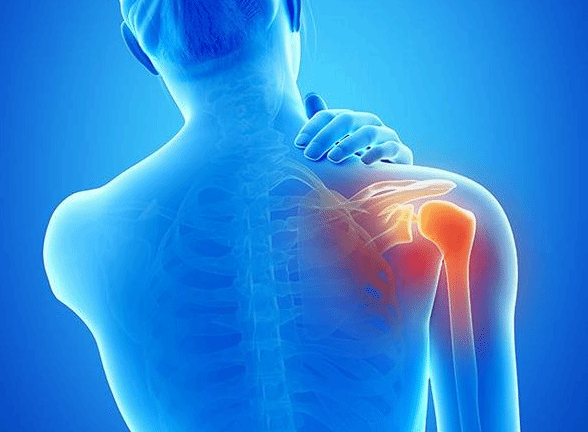 肩膀痛就是因为肩周炎吗？肩周炎有哪些症状