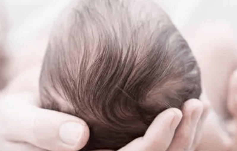 小儿头发稀少是怎么回事？这5个原因可以一一排查