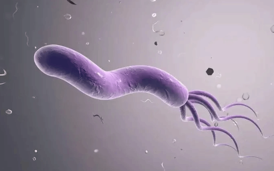 感染上幽门螺杆菌意味着可能得胃癌了吗
