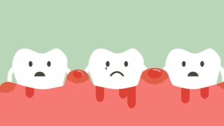 青春期牙龈炎有哪些症状？早发现早治疗