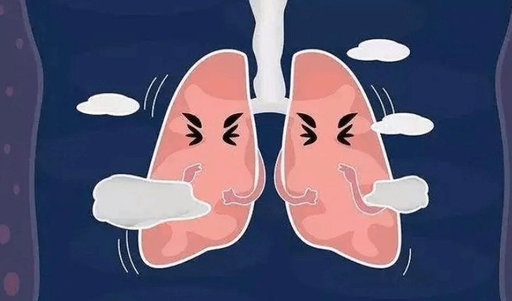 正确认识肺癌 这些肺部养护误区你要知道