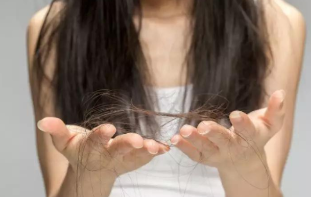 出现4种发质需重视 做好四点避免头发受伤
