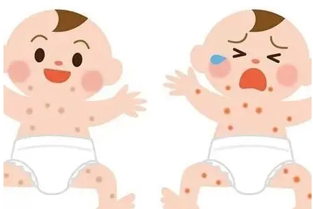宝宝脸上长红疹有可能是长奶癣 要做好这6大护理
