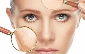 面部皮肤过敏怎么办？这5个方法或许可缓解