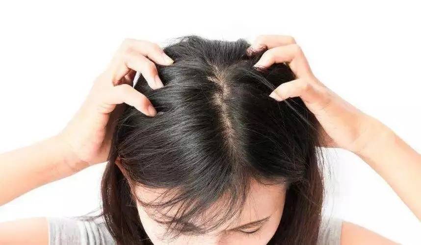 总是掉头发怎么办 5个小方法能拯救你的发际线
