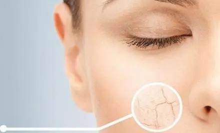 皮肤干燥的原因是什么？这4种原因值得注意