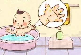 宝宝患上湿疹一定要忌口吗？也不能经常洗澡吗