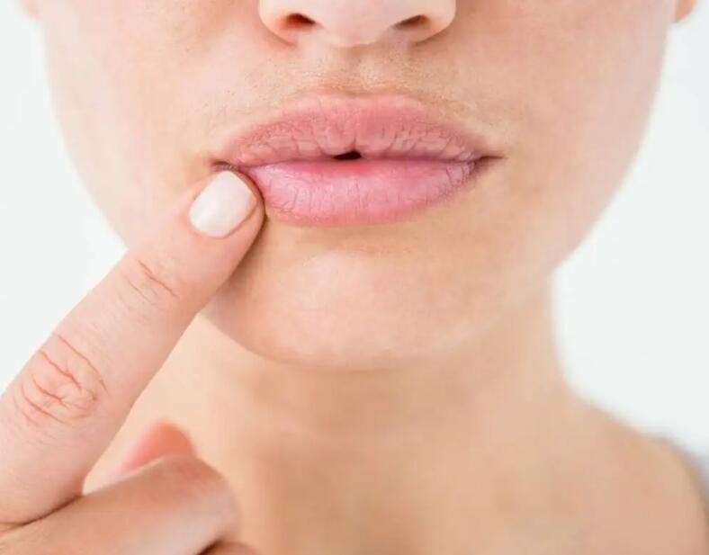 你的嘴唇皮肤是如何变老的？跟2种因素有关