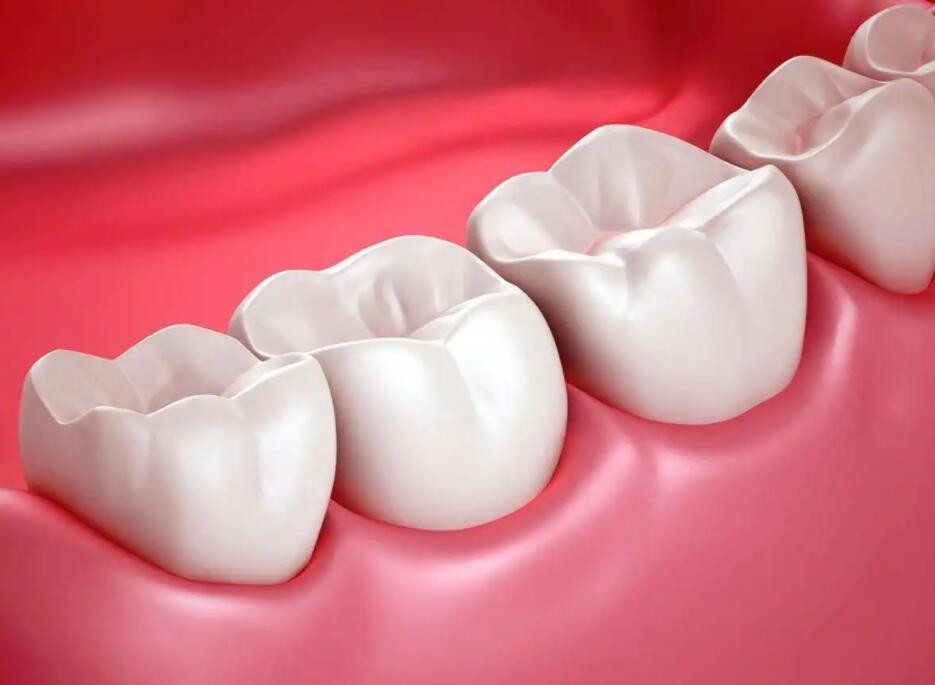 它是牙周炎的罪魁祸首？6个特征提示牙菌斑堆积