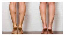 女生如何快速瘦大腿？赶快试试这四种方法