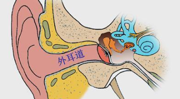 外耳道真菌病有哪些表现？预防做好这三点