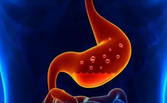 哪些人易发生胃食管反流？会诱发食管腺癌