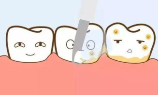 洗牙能让牙齿变白吗？哪种情况下需要洗牙